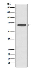 Western blot analysis of Phospho-PKC zeta (T560) expression in HeLa cell treated with Calyculin A lysate.