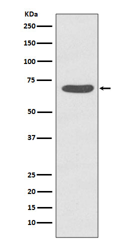 Western blot analysis of Phospho-PKC zeta (T560) expression in HeLa cell treated with Calyculin A lysate.