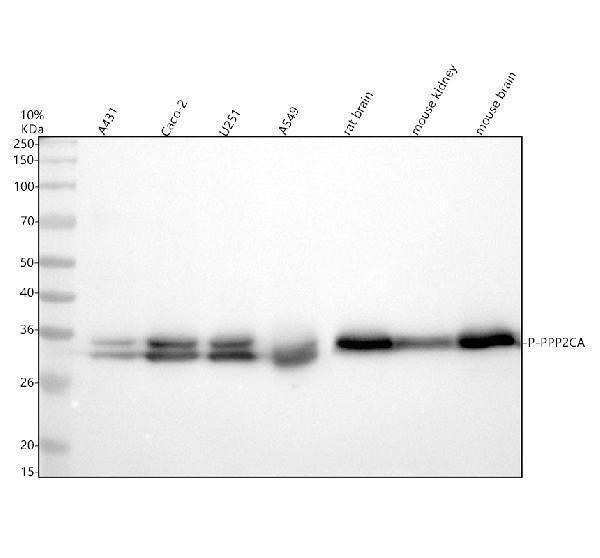 Anti-Phospho-PP2A alpha (Y307) PPP2CA Rabbit Monoclonal Antibody