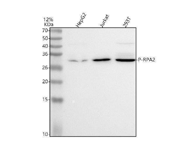 Anti-Phospho-RPA2 (T21) Rabbit Monoclonal Antibody
