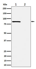 Western blot analysis of Phospho-Rad17 (S656) expression in (1) HeLa cell treated with CA lysate; (2) HeLa cell lysate.