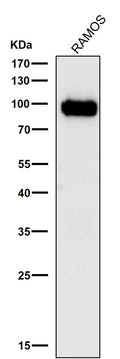 All lanes use the Antibody at 1:3K dilution for 1 hour at room temperature.