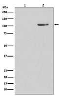 Western blot analysis of Phospho-GluR1 (S845) expression in (1) Human brain lysate treated with Lambda phosphatase lysate; (2) Human brain lysate.