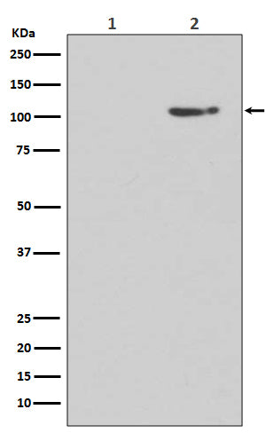Western blot analysis of Phospho-GluR1 (S845) expression in (1) Human brain lysate treated with Lambda phosphatase lysate; (2) Human brain lysate.