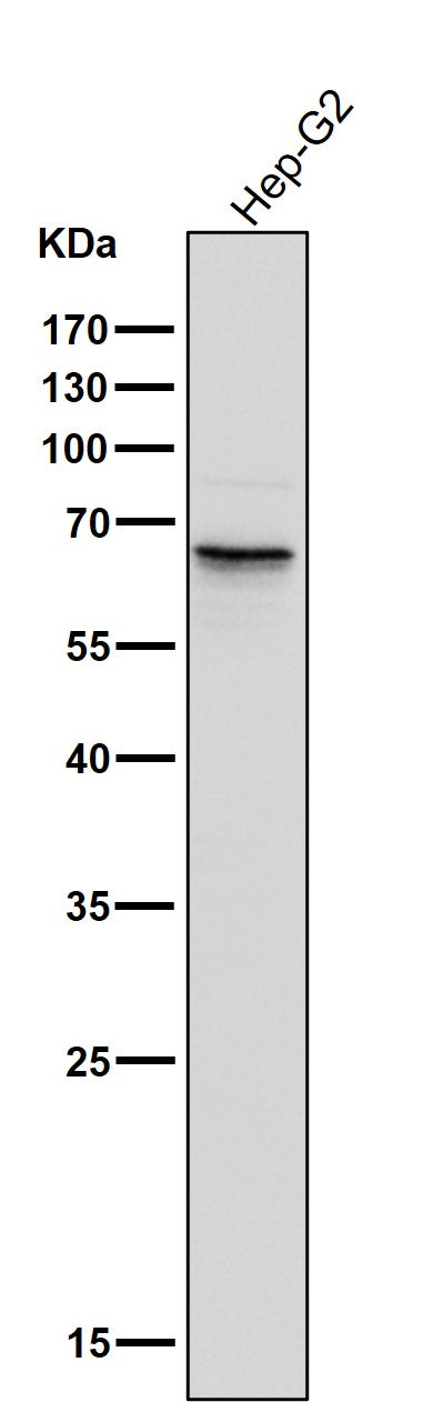 All lanes use the Antibody at 1:3K dilution for 1 hour at room temperature.