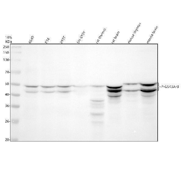 Anti-Phospho-GSK3 (alpha + beta) (Y216 + Y279) GSK3A Rabbit Monoclonal Antibody