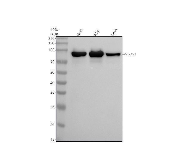 Anti-Phospho-Glycogen synthase 1 (S641) GYS1 Rabbit Monoclonal Antibody