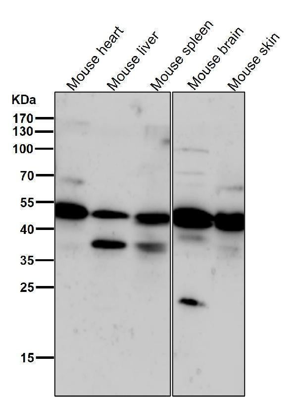 All lanes use the Antibody at 1:1K dilution for 1 hour at room temperature.