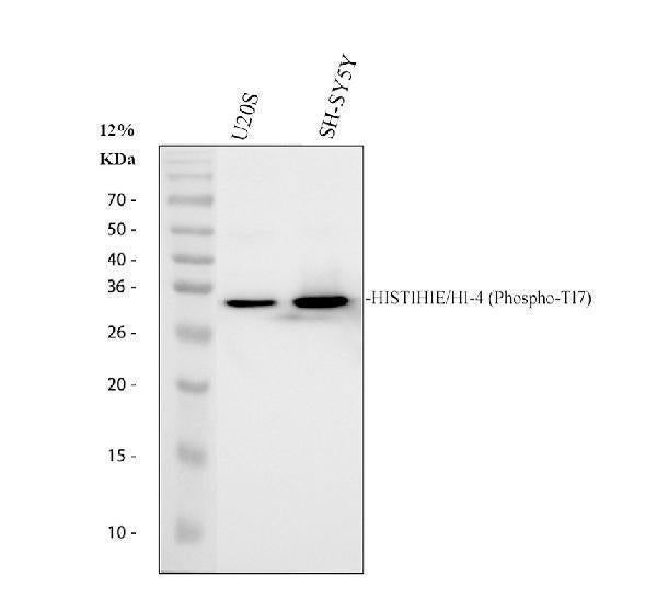 Anti-Phospho-Histone H1.4 (T17) HIST1H1E Rabbit Monoclonal Antibody