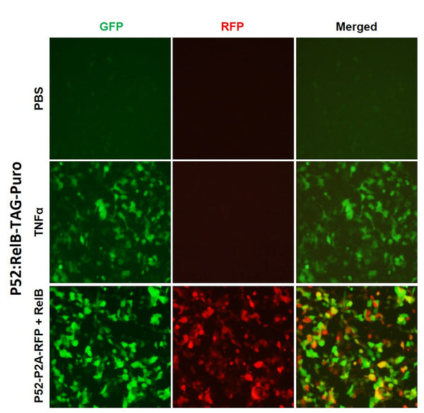 p52:RelB Reporter Lentivirus – Figure 1 of 2