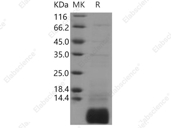 Recombinant Human GNGT1/GNG1 Protein (His Tag) - Figure 1 of 2