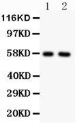 All lanes: Anti ALPL (PA1004-1) at 0.5ug/ml
Lane 1: Rat Cardiac Muscle Tissue Lysate at 50ug
Lane 2: Rat Brain Tissue Lysate at 50ug
Predicted bind size: 57KD
Observed bind size: 57KD