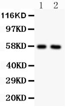 All lanes: Anti ALPL (PA1004-1) at 0.5ug/ml
Lane 1: Rat Cardiac Muscle Tissue Lysate at 50ug
Lane 2: Rat Brain Tissue Lysate at 50ug
Predicted bind size: 57KD
Observed bind size: 57KD