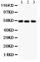 All lanes: Anti ALPL (PA1004-2) at 0.5ug/ml
Lane 1: Human Placenta Tissue Lysate at 50ug
Lane 2: HT1080 Whole Cell Lysate at 40ug
Lane 3: JURKAT Whole Cell Lysate at 40ug
Predicted bind size: 57KD
Observed bind size: 57KD