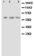 Anti-Angiopoietin 2 antibody, PA1005, Western blotting
Lane 1: Recombinant Human ANG2 Protein 10ng
Lane 2: Recombinant Human ANG2 Protein 5ng
Lane 3: Recombinant Human ANG2 Protein 2.5ng
