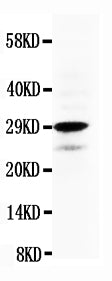 Anti-Calretinin/CALB2 Antibody Picoband®