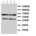 Anti-CCR5 antibody, PA1016-1, Western blotting
Lane 1: COLO320 Cell Lysate
Lane 2: MCF-7 Cell Lysate
Lane 3: SMMC Cell Lysate
Lane 4: JURKAT Cell Lysate