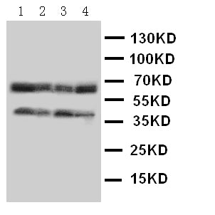Anti-CCR5 antibody, PA1016-1, Western blotting
Lane 1: COLO320 Cell Lysate
Lane 2: MCF-7 Cell Lysate
Lane 3: SMMC Cell Lysate
Lane 4: JURKAT Cell Lysate