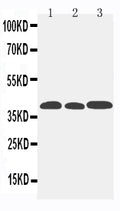 Anti-CCR5 antibody, PA1016-2, Western blotting
Lane 1: Mouse Lung Tissue Lysate
Lane 2: Mouse Intestine Tissue Lysate
Lane 3: Mouse Kidney Tissue Lysate