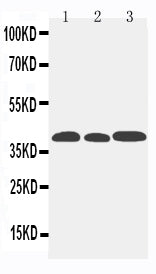 Anti-CCR5 antibody, PA1016-2, Western blotting
Lane 1: Mouse Lung Tissue Lysate
Lane 2: Mouse Intestine Tissue Lysate
Lane 3: Mouse Kidney Tissue Lysate