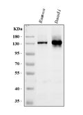 Anti-B-cell receptor CD22 CD22 Antibody Picoband®