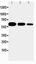Anti-CD40 antibody, PA1019, Western blotting
Lane 1: Recombinant Mouse CD 40 Protein 10ng
Lane 2: Recombinant Mouse CD 40 Protein 5ng
Lane 3: Recombinant Mouse CD 40 Protein 2.5ng