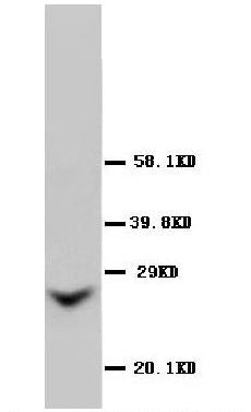 Anti-GJB2 antibody, PA1025, Western blotting
WB: Rat Liver Tissue Lysate
