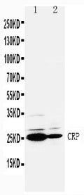 Anti-C Reactive Protein antibody, PA1028, Western blotting
Lane 1: SMMC Cell Lysate
Lane 2: HT1080 Cell Lysate