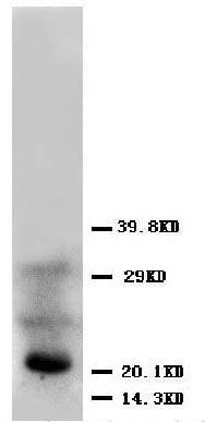 Anti-FGF4 antibody, PA1033, Western blotting
WB: HELA Cell Lysate