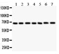Anti-GAD67/GAD1 Antibody Picoband®