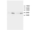 Anti-HMGB4 antibody, PA1042, Western blotting
Lane 1: Rat Brain Tissue Lysate
Lane 2: Rat Testis Tissue Lysate
Lane 3: JURKAT Cell Lysate
Lane 4: HT1080 Cell Lysate