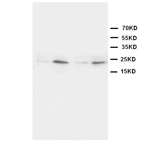 Anti-HMGB4 antibody, PA1042, Western blotting
Lane 1: Rat Brain Tissue Lysate
Lane 2: Rat Testis Tissue Lysate
Lane 3: JURKAT Cell Lysate
Lane 4: HT1080 Cell Lysate