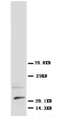Anti-NGF antibody, PA1056, Western blotting
WB: Rat Brain Tissue Lysate