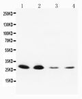 Anti-Neurotrophin 3 antibody, PA1062, Western blotting
Lane 1: Rat Brain Tissue Lysate
Lane 2: Rat Brain Tissue Lysate
Lane 3: MCF-7 Cell Lysate
Lane 4: HELA Cell Lysate