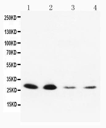 Anti-Neurotrophin 3 antibody, PA1062, Western blotting
Lane 1: Rat Brain Tissue Lysate
Lane 2: Rat Brain Tissue Lysate
Lane 3: MCF-7 Cell Lysate
Lane 4: HELA Cell Lysate