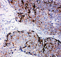 Anti-Metalloproteinase inhibitor 2 TIMP2 Antibody