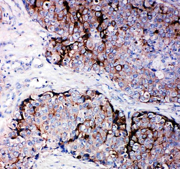 Anti-Metalloproteinase inhibitor 2 TIMP2 Antibody