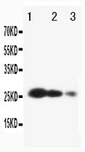 Anti-TIMP3 antibody, PA1077, Western blotting
Lane 1: Recombinant Human TIMP3 Protein 10ng
Lane 2: Recombinant Human TIMP3 Protein 5ng
Lane 3: Recombinant Human TIMP3 Protein 2.5ng