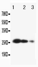 Anti-TIMP3 antibody, PA1077, Western blotting
Lane 1: Recombinant Human TIMP3 Protein 10ng
Lane 2: Recombinant Human TIMP3 Protein 5ng
Lane 3: Recombinant Human TIMP3 Protein 2.5ng