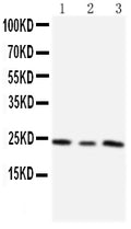 Anti-TIMP4 antibody, PA1078-1, Western blotting
Lane 1: HT1080 Cell Lysate
Lane 2: HELA Cell Lysate
Lane 3: SMMC Cell Lysate