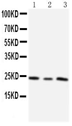 Anti-TIMP4 antibody, PA1078-1, Western blotting
Lane 1: HT1080 Cell Lysate
Lane 2: HELA Cell Lysate
Lane 3: SMMC Cell Lysate