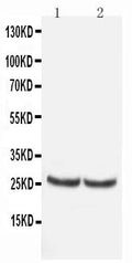 Anti-TIMP4 antibody, PA1078, Western blotting
All lanes: Anti TIMP4 (PA1078) at 0.5ug/ml
Lane 1: Rat Kidney Tissue Lysate at 50ug
Lane 2: MCF-7 Whole Cell Lysate at 40ug
Predicted bind size: 25KD
Observed bind size: 25KD