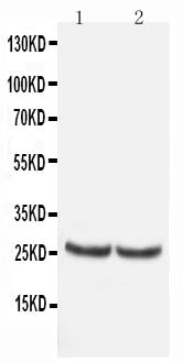 Anti-TIMP4 antibody, PA1078, Western blotting
All lanes: Anti TIMP4 (PA1078) at 0.5ug/ml
Lane 1: Rat Kidney Tissue Lysate at 50ug
Lane 2: MCF-7 Whole Cell Lysate at 40ug
Predicted bind size: 25KD
Observed bind size: 25KD