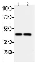 Anti-Caspase-2 antibody, PA1113, Western blotting
Lane 1: CEM Cell Lysate
Lane 2: SMMC Cell Lysate