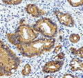 Anti-gamma Catenin/JUP Antibody Picoband®