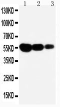 Anti-Fas antibody, PA1119, Western blotting
Lane 1: Recombinant Mouse FAS Protein 10ng
Lane 2: Recombinant Mouse FAS Protein 5ng
Lane 3: Recombinant Mouse FAS Protein 2.5ng