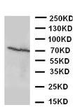 Anti-Estrogen Receptor beta antibody, PA1126, Western blotting
WB: MCF-7 Cell Lysate