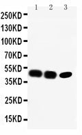 Anti-CCR6 antibody, PA1201, Western blotting
Lane 1: Rat Liver Tissue Lysate
Lane 2: SW620 Cell Lysate
Lane 3: CEM Cell Lysate
