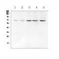 Anti-Chk2/CHEK2 Antibody Picoband®