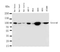 Anti-beta Catenin antibody, PA1212-1, Western blotting
Lane 1: Rat Brain Tissue Lysate
Lane 2: Rat Heart Tissue Lysate
Lane 3: Rat Testis Tissue Lysate
Lane 4: MCF-7 Cell Lysate
Lane 5: HELA Cell Lysate
Lane 6: M453 Cell Lysate
Lane 7: M231 Cell Lysate

Lane 8: HT1080 Cell Lysate